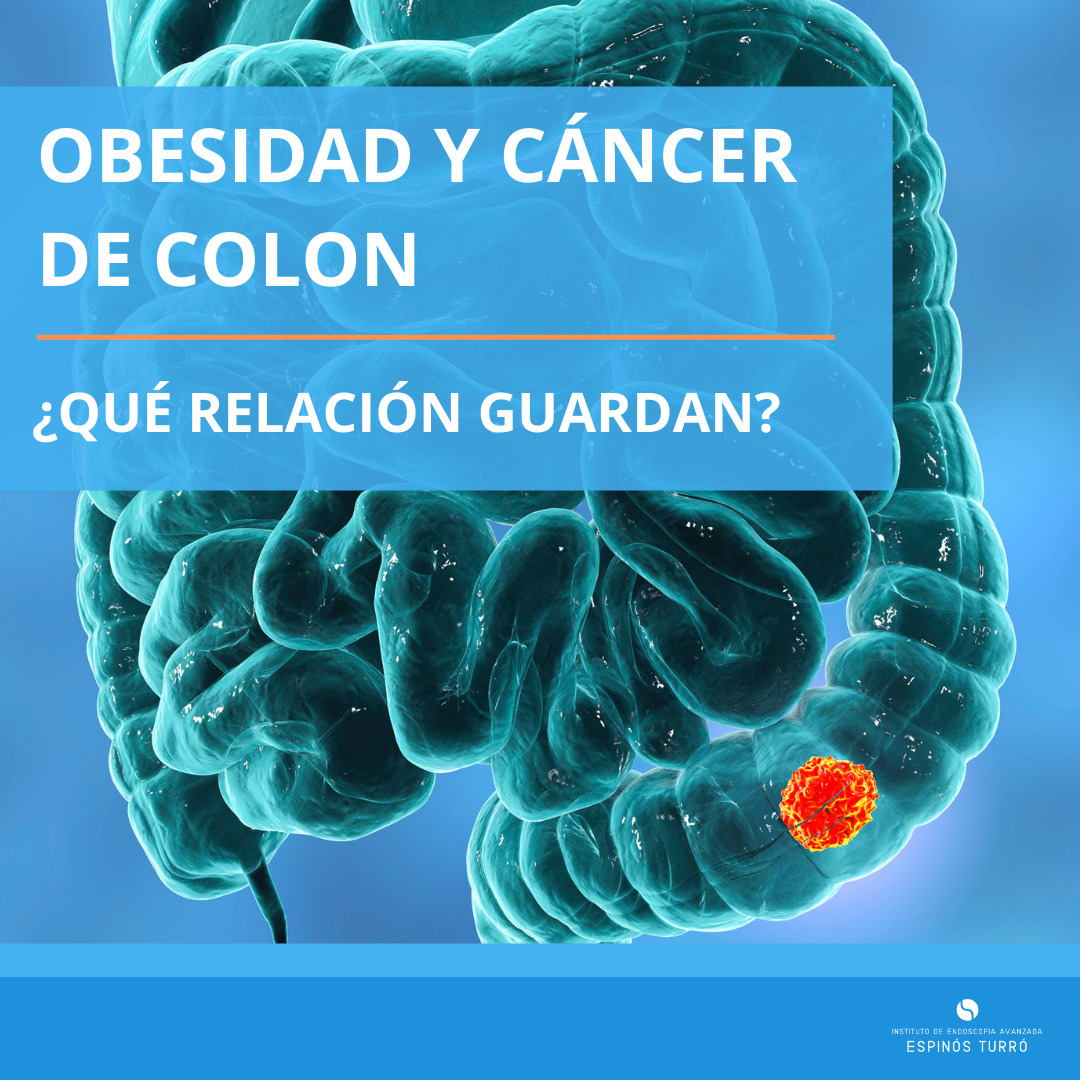 relación entre la obesidad y el cáncer de colon por Instituto de endoscopia avanzada Espinós Turró Dr. Román Turró