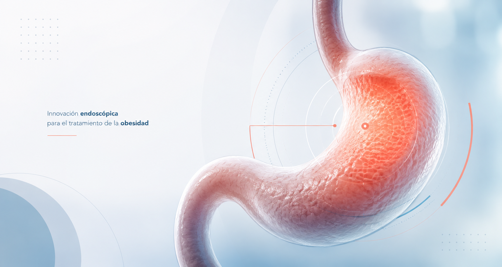 Estómago con enfoque en la mucosa del fundus gástrico en donde se hace la técnica de la ablación para reducir la grelina, la hormona del hambre, y por tanto, reducir el apetito